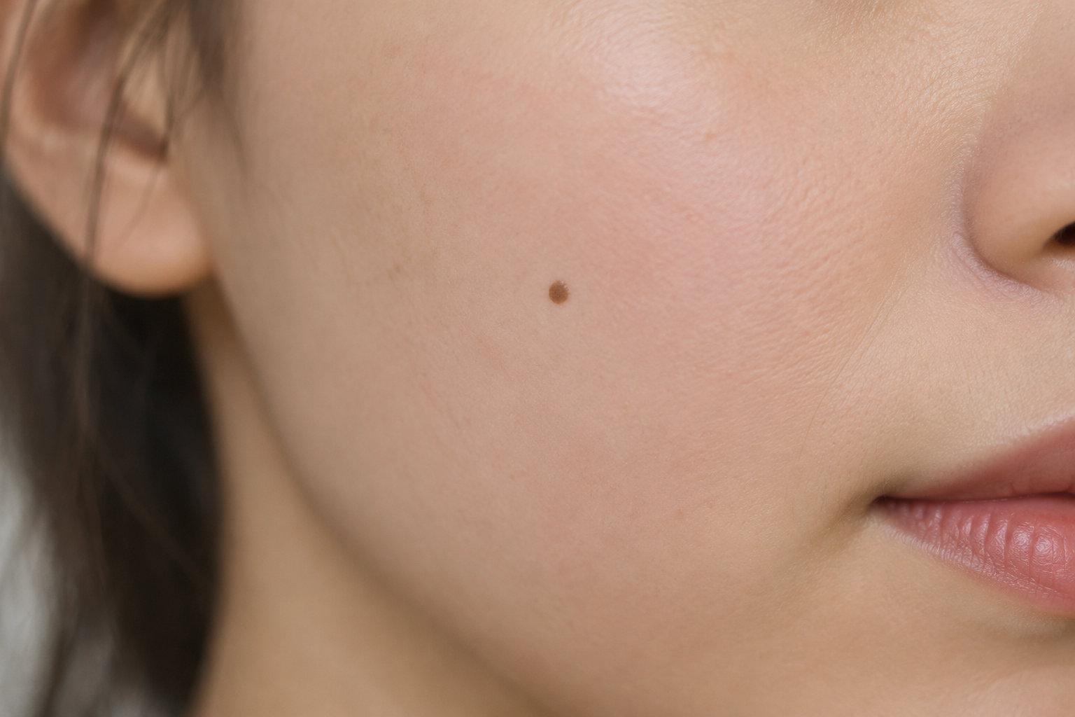 Gros plan sur une joue avec un petit grain de beauté, près du nez et des lèvres.