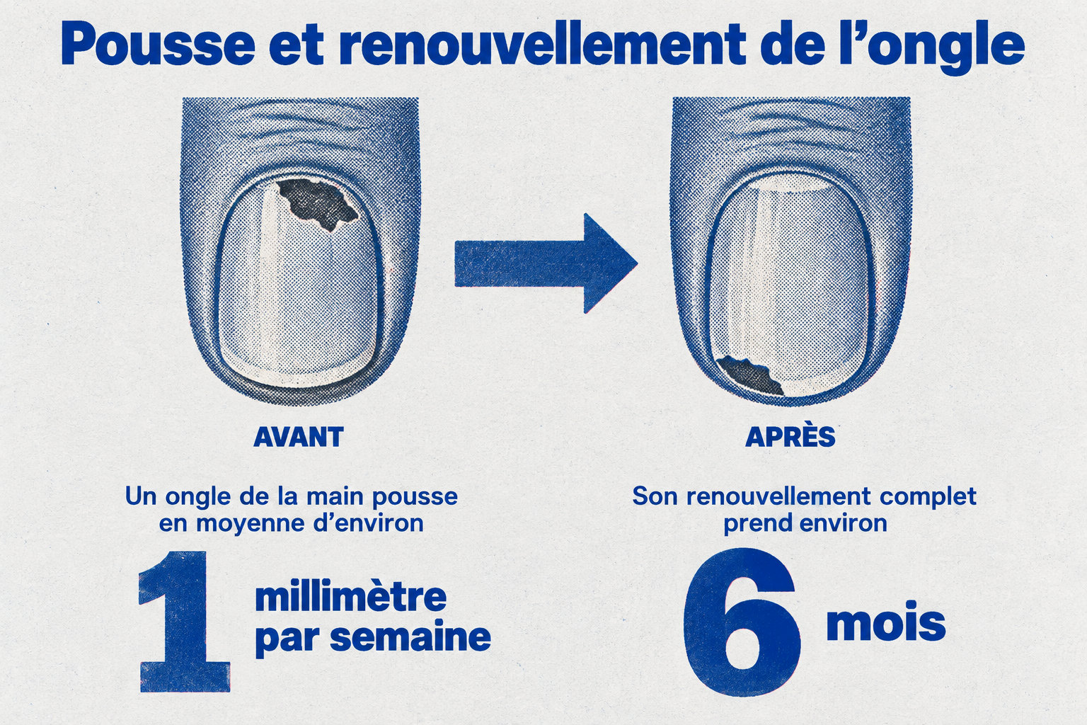 Un ongle de la main pousse en moyenne d’environ 1 millimètre par semaine et son renouvellement complet prend environ 6 mois ; la partie abîmée avance jusqu’au bord libre pour disparaître.